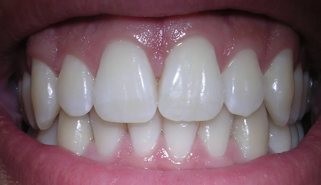 1 Introduction 1.24 Teeth