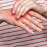 Want To Control Uric Acid? Stay Away From These Foods
